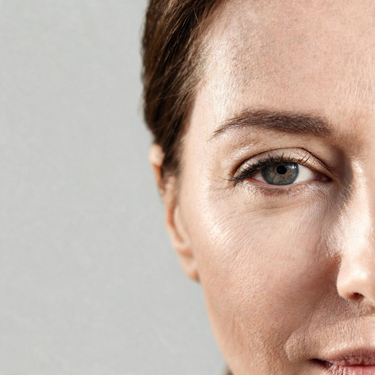 Close view of the eye area showing fine expression lines - Skingenetix fine lines and wrinkles peptide range