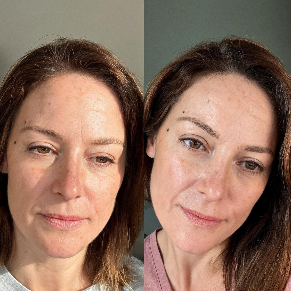 Before and after photographs from a Skingenetix customer, showing mid-face brightness and clarity