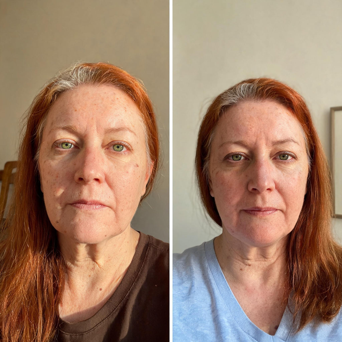 Before and after skin comparison showing firmer, better supported skin along the jaw and cheek