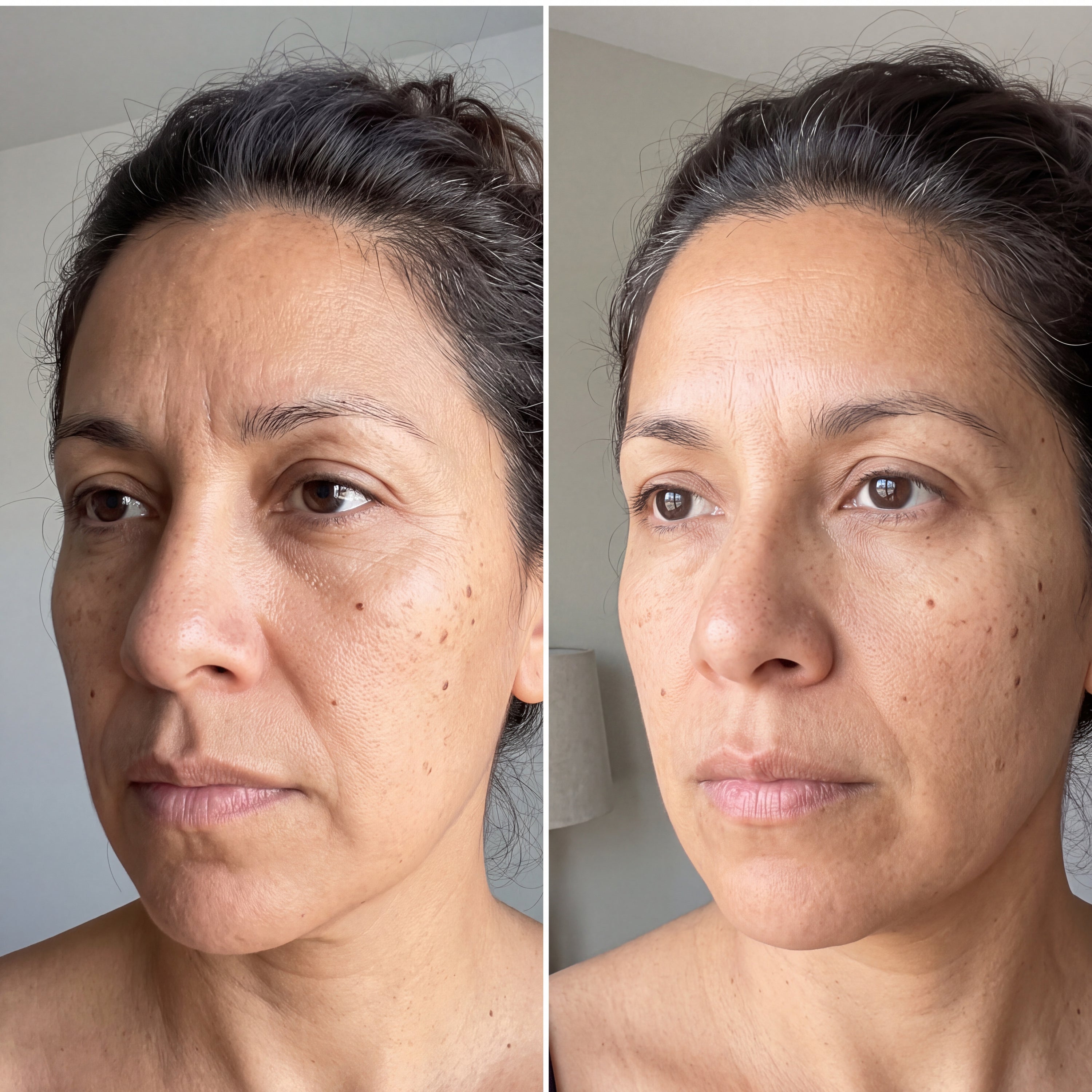 Before and after skin comparison showing firmer, better supported skin along the jaw and cheek