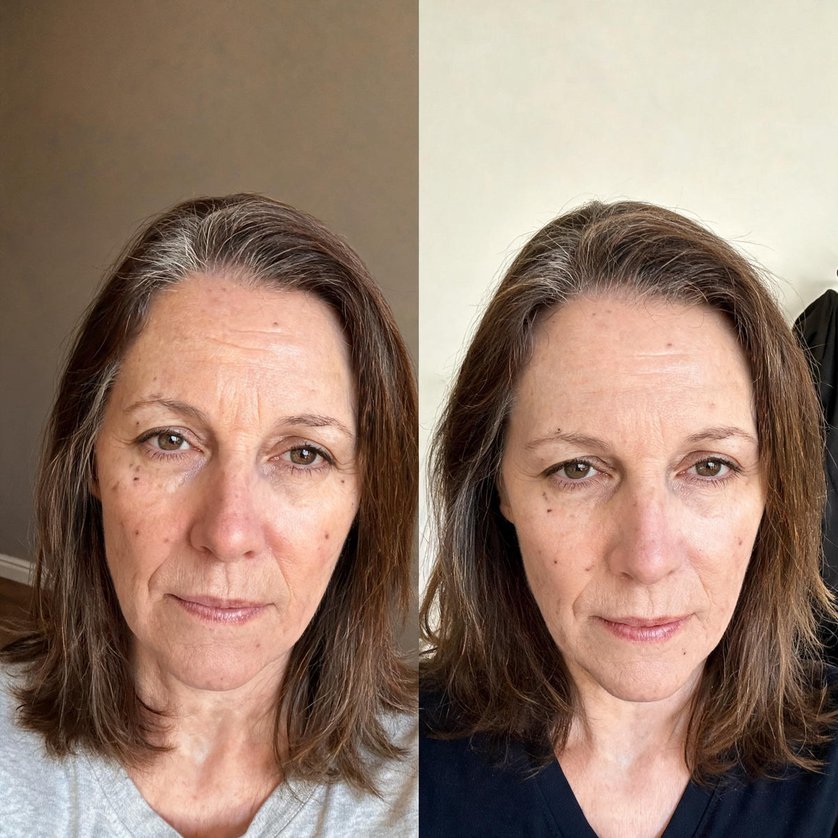 Before and after skin comparison showing improved skin condition and texture
