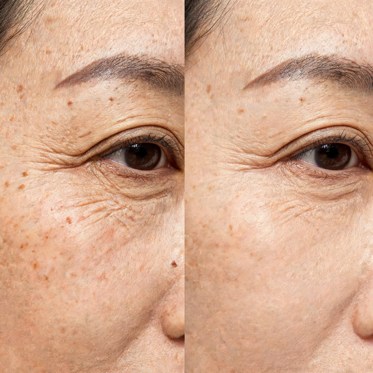 Before and after skin comparison showing improved skin condition and texture