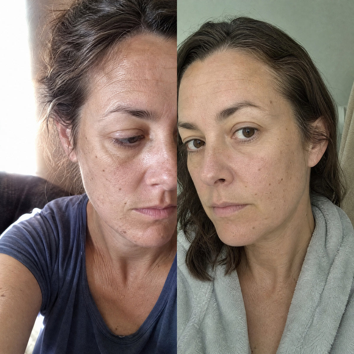 Before and after skin comparison showing softer fine lines and wrinkles