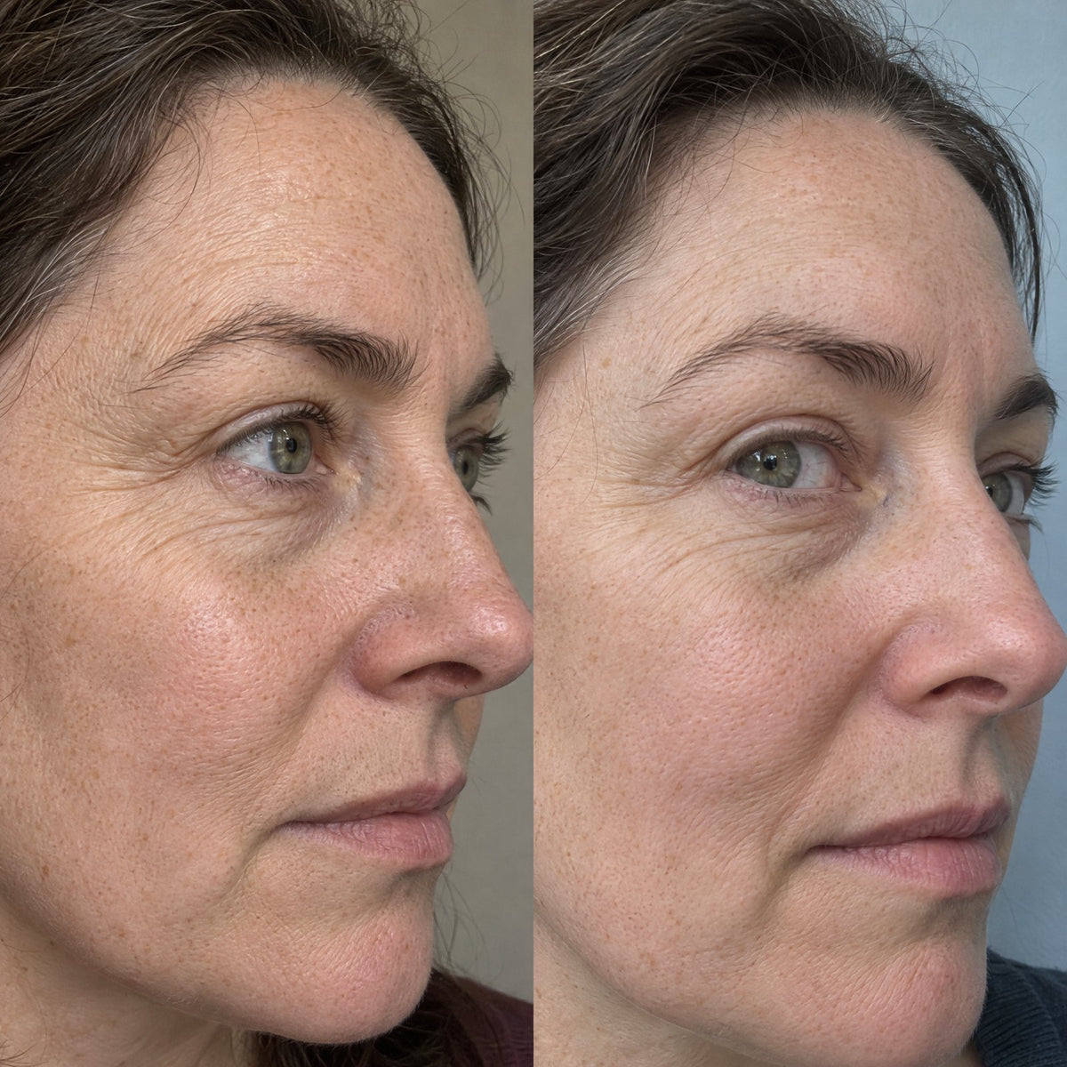 Before and after: crow's feet and fine lines beside the eye, every line kept, about a quarter softer