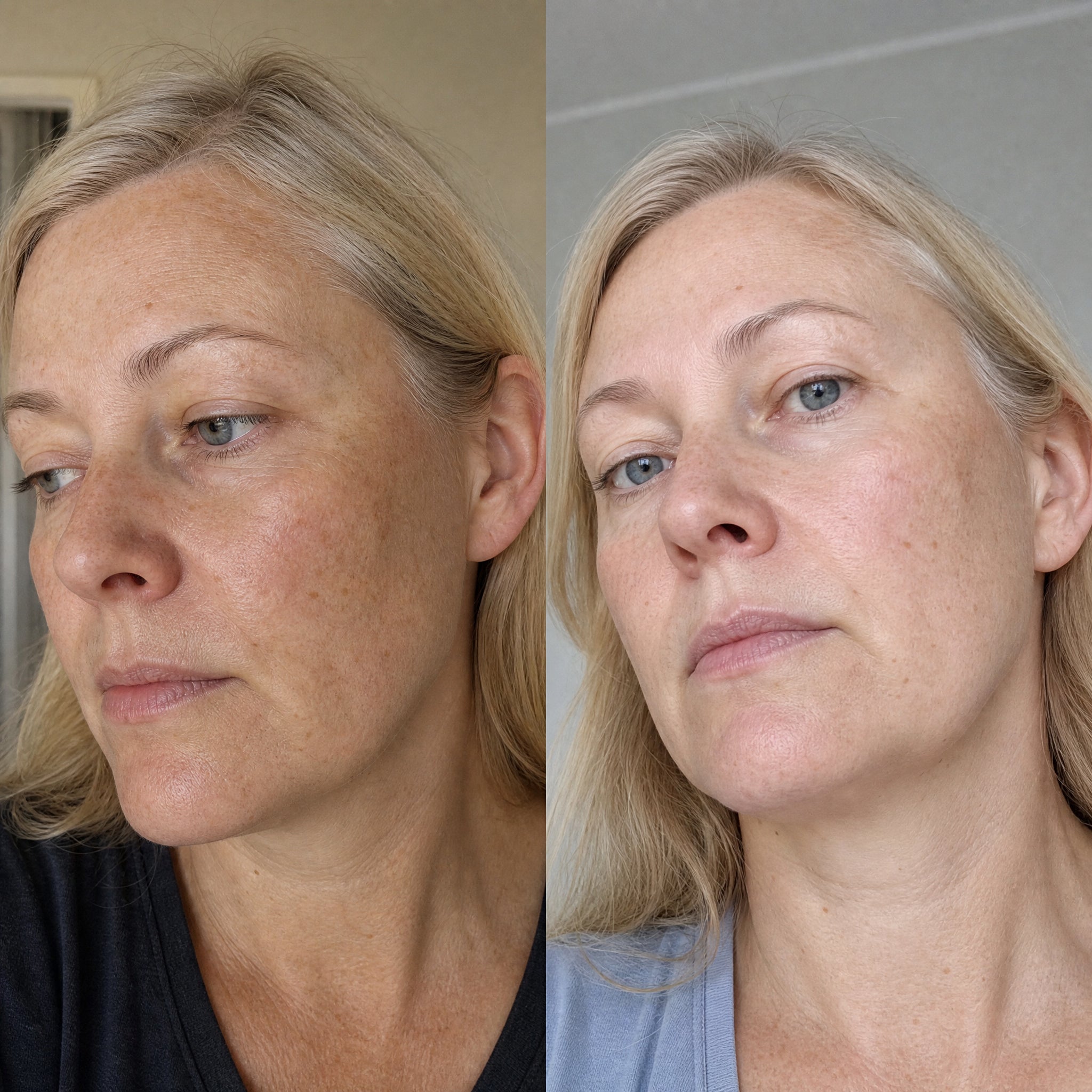 Before and after skin comparison showing a more even, brighter skin tone
