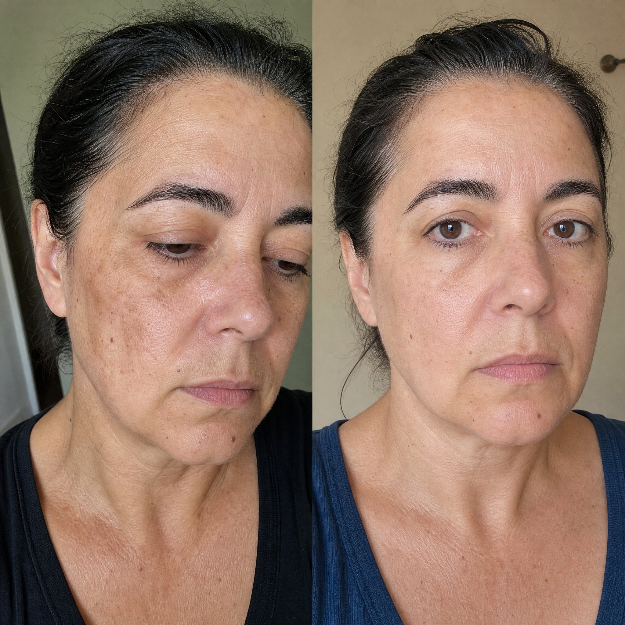 Before and after skin comparison showing a more even, brighter skin tone