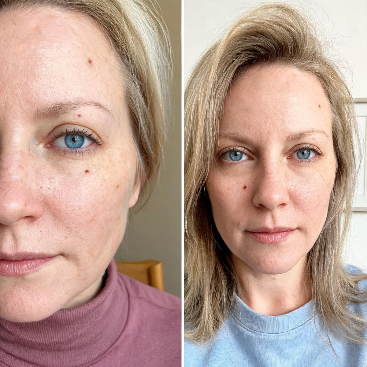 Before and after skin comparison showing a more even, brighter skin tone