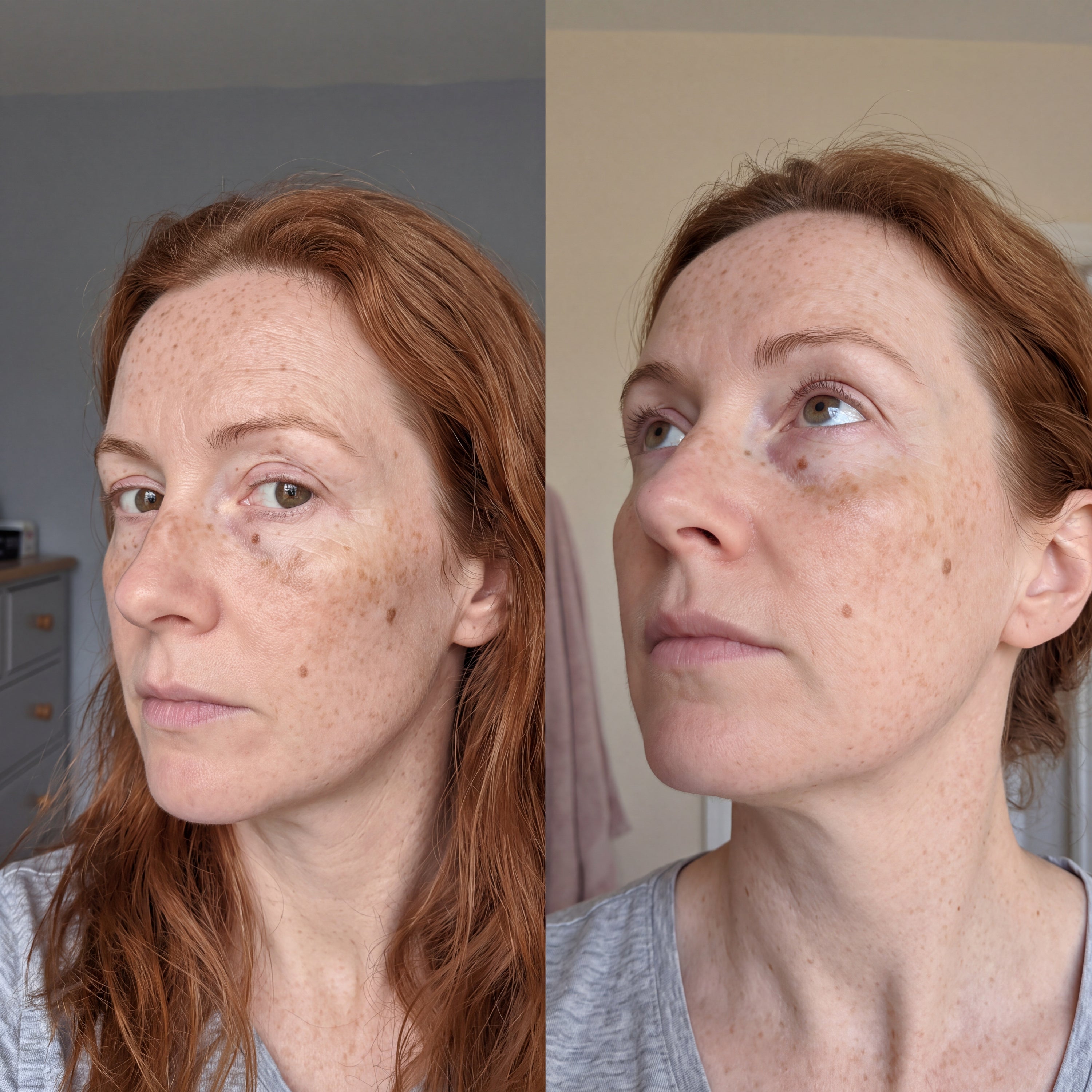 Before and after skin comparison showing a more even, brighter skin tone