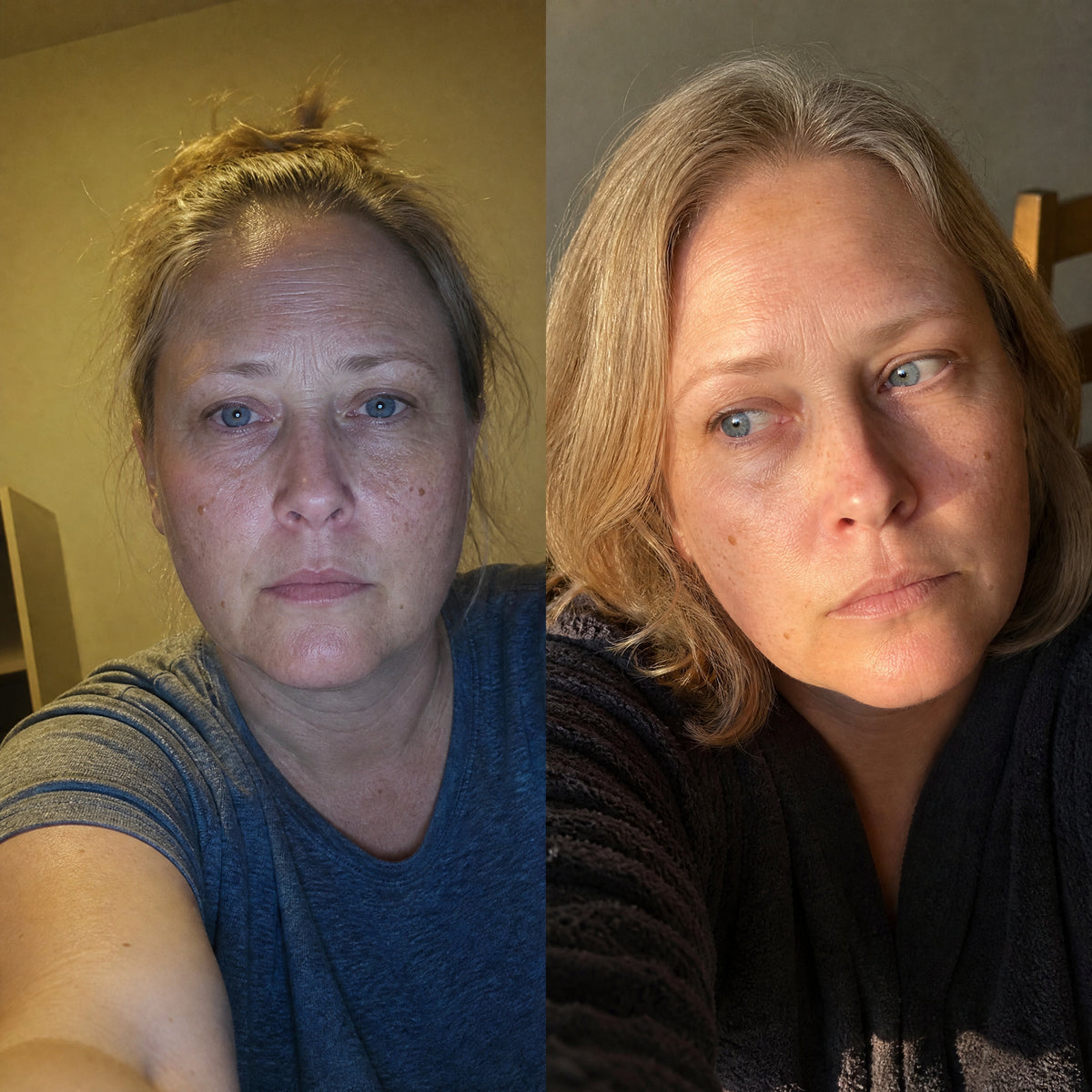 Before and after skin comparison showing firmer, better supported skin along the jaw and cheek