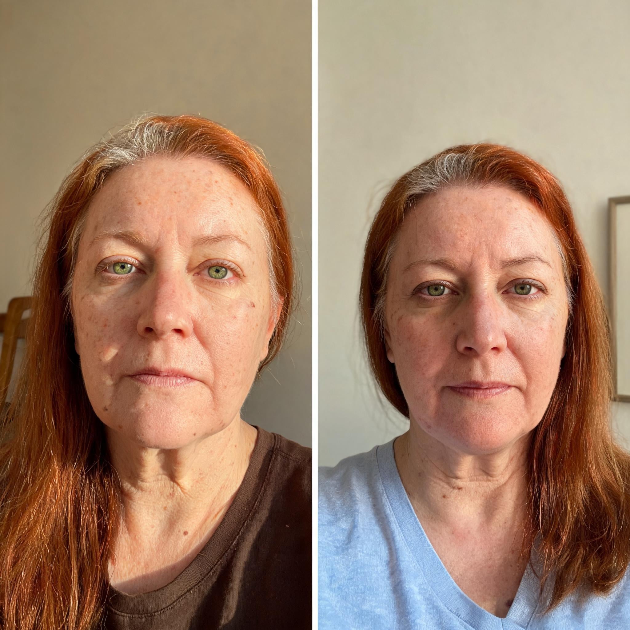Before and after skin comparison showing firmer, better supported skin along the jaw and cheek