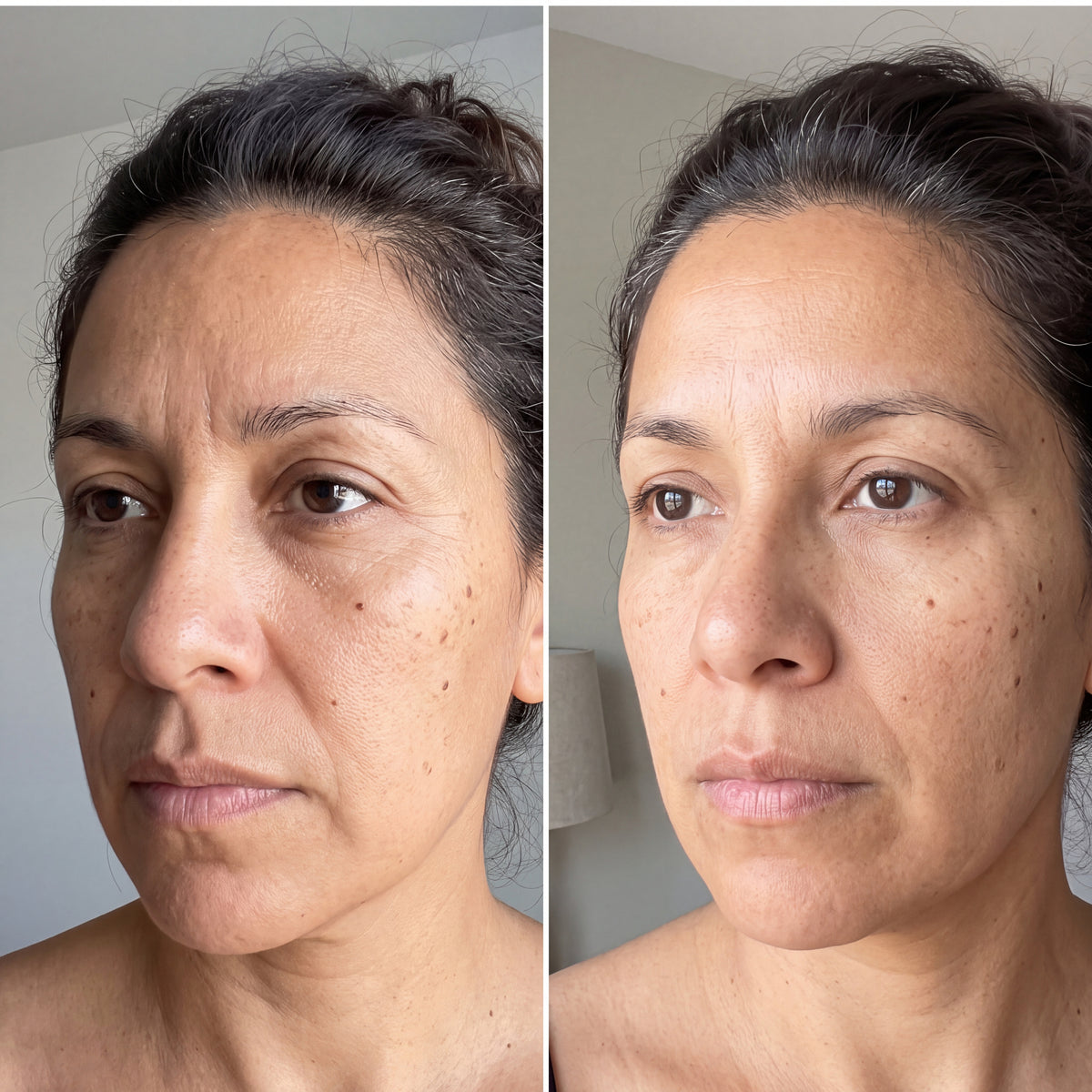 Before and after skin comparison showing firmer, better supported skin along the jaw and cheek