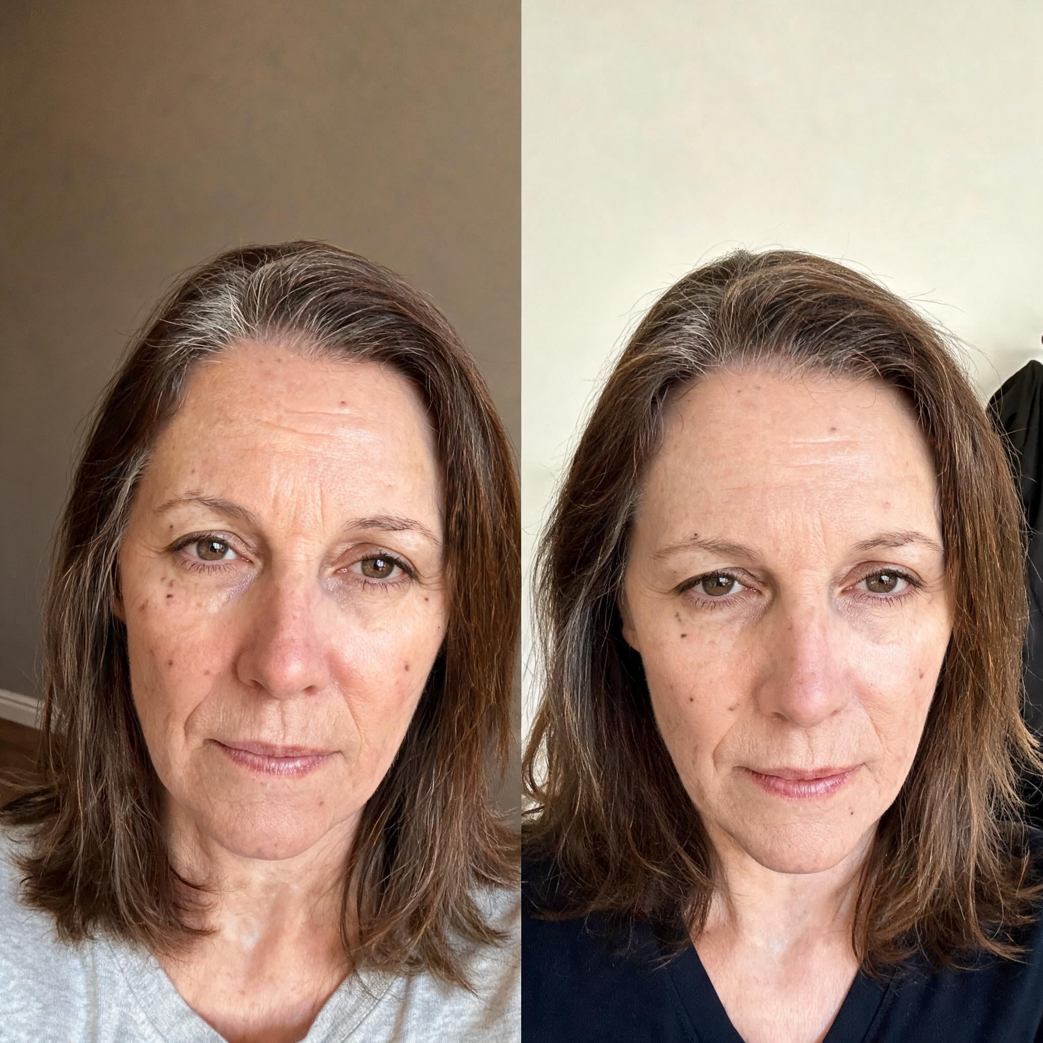 Before and after skin comparison showing improved skin condition and texture
