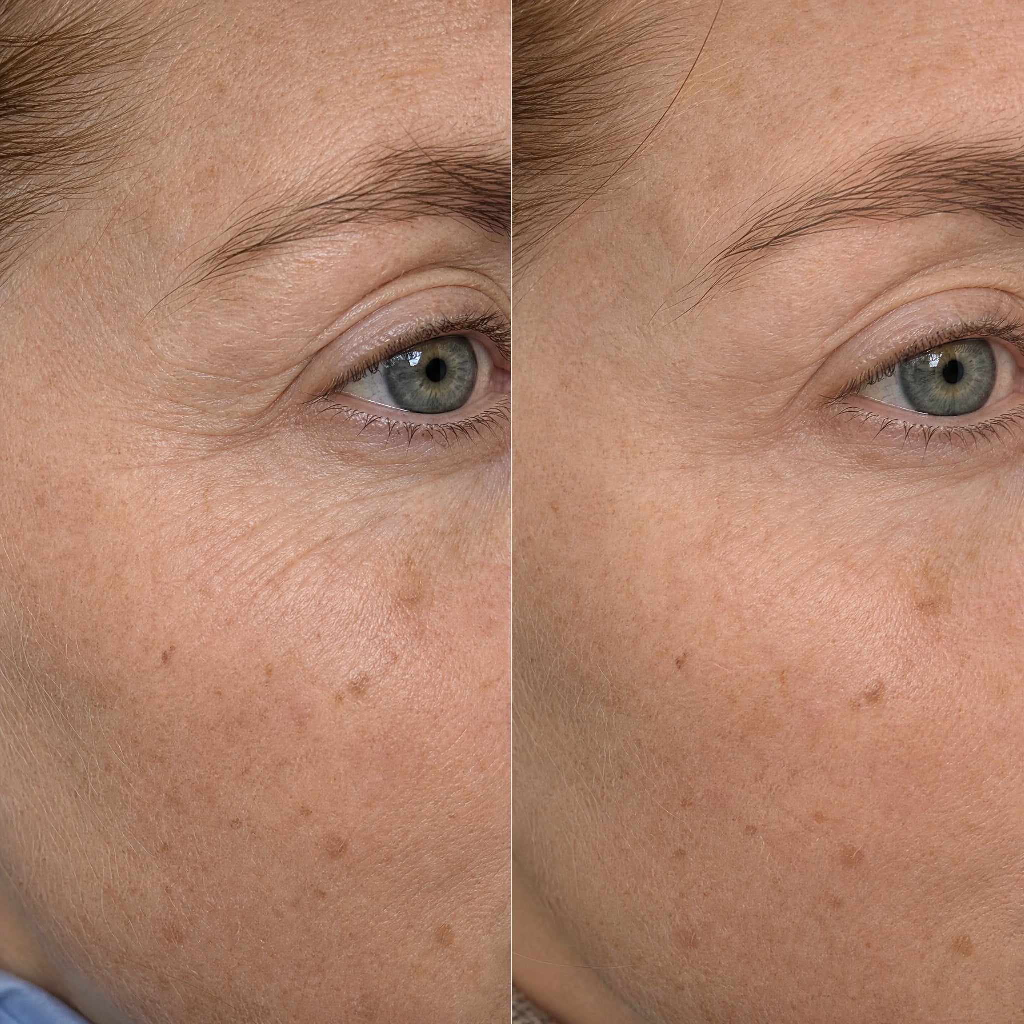Before and after skin comparison showing improved skin condition and texture