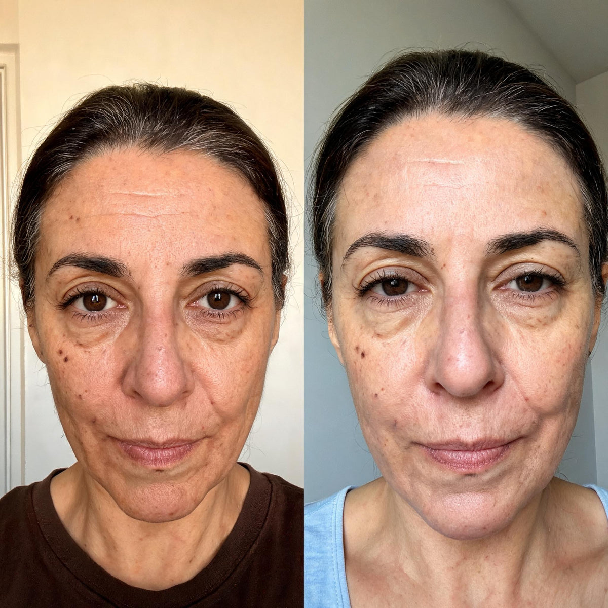 Before and after skin comparison showing improved skin condition and texture