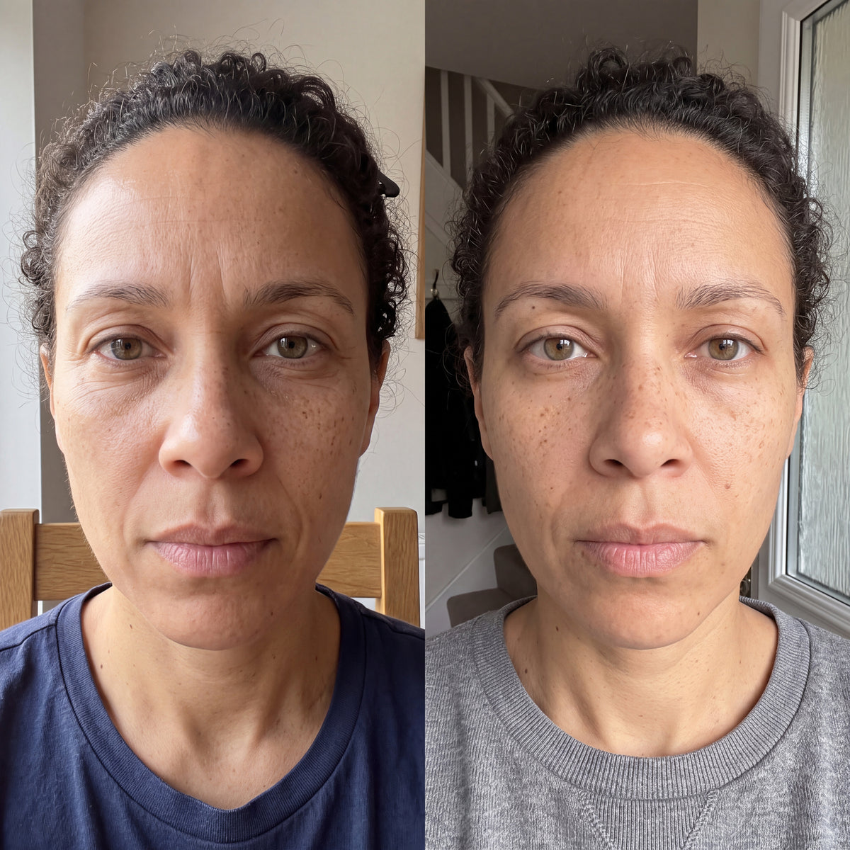 Before and after skin comparison showing improved skin condition and texture