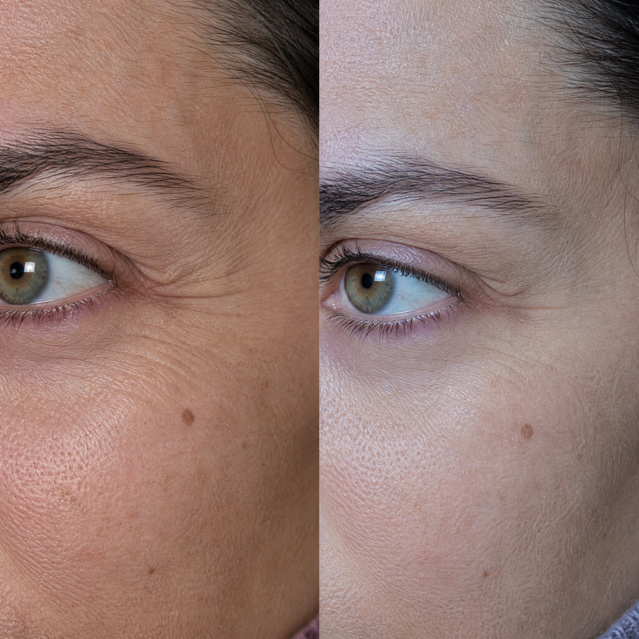 Before and after skin comparison showing improved skin condition and texture